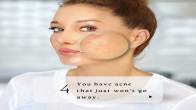 Acne scar removal treatment in Hyderabad