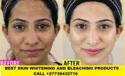 Skin Lightening Skin Whitening Products +27738432716 - Sharjah-Medical services